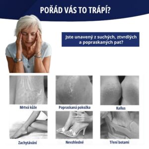 4dílný pomocník pro péči o nohy - SoftFeet - Image 3