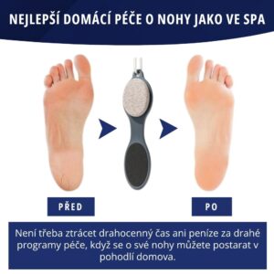4dílný pomocník pro péči o nohy - SoftFeet - Image 4