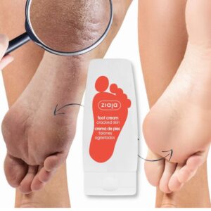ZIAJA Krém na popraskanou pokožku chodidel 60 ml - Image 4