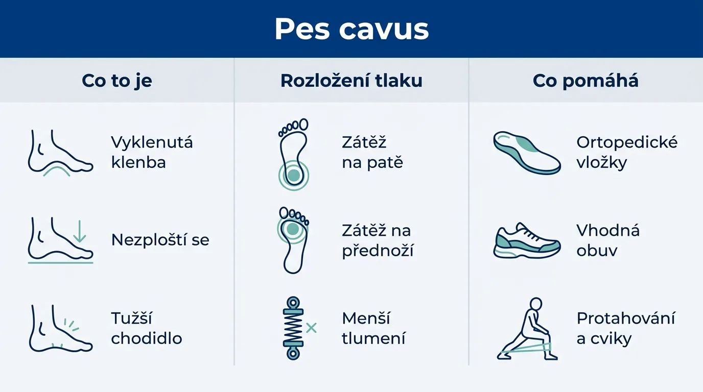 Infografika vysvětlující, co je vysoká klenba nohy, jak mění rozložení tlaku a co pomáhá.